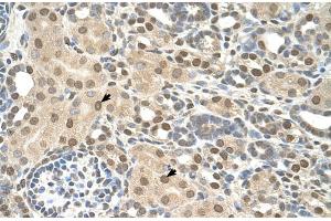 Rabbit Anti-TMEM30A Antibody  Paraffin Embedded Tissue: Human Kidney Cellular Data: Epithelial cells of renal tubule Antibody Concentration: 4. (TMEM30A anticorps  (Middle Region))