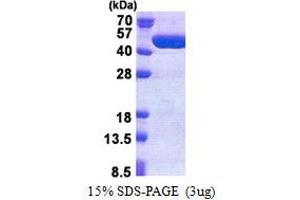 SDS-PAGE (SDS) image for TBC1 Domain Family, Member 13 (TBC1D13) (AA 1-400) protein (His tag) (ABIN5853203)