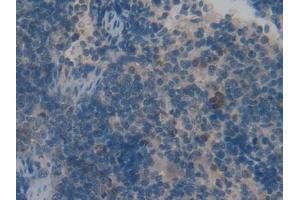 Detection of VIP in Rat Spleen Tissue using Polyclonal Antibody to Vasoactive Intestinal Peptide (VIP)