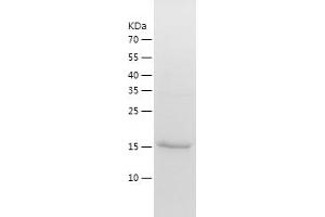 Western Blotting (WB) image for Hepatitis B Virus X-Interacting Protein (HBXIP) (AA 1-173) protein (His-IF2DI Tag) (ABIN7123303)