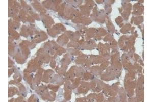 Detection of CAMK2a in Rat Heart Tissue using Polyclonal Antibody to Calcium/Calmodulin Dependent Protein Kinase II Alpha (CAMK2a)