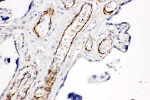 Anti-CD168 antibody, IHC(P) IHC(P): Human Placenta Tissue (HMMR anticorps  (C-Term))