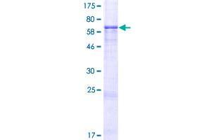 Image no. 1 for Immediate Early Response 5 (IER5) (AA 1-327) protein (GST tag) (ABIN1307398)