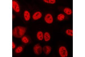 ABIN6268709 staining lovo cells by ICC/IF. (Lamin B anticorps)