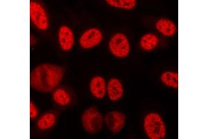 ABIN6268709 staining lovo cells by ICC/IF. (Lamin B anticorps)