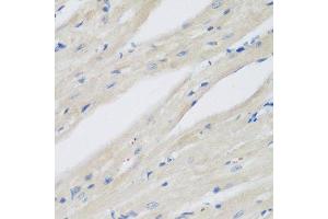 Immunohistochemistry of paraffin-embedded mouse heart using NAA50 antibody. (NAA50 anticorps  (AA 1-169))