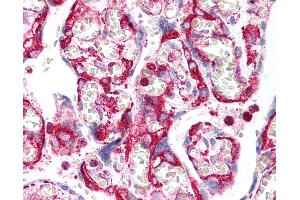 Anti-INHA / Inhibin Alpha antibody IHC of human placenta. (Inhibin alpha anticorps)