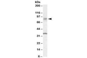 Western blot testing of human substantia nigra lysate with ANKK1 antibody at 0. (ANKK1 anticorps)