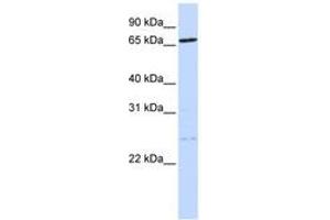 Image no. 1 for anti-Tousled-Like Kinase 1 (TLK1) (AA 108-157) antibody (ABIN6744260) (TLK1 anticorps  (AA 108-157))