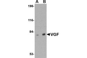 Western blot analysis of VGF in human brain tissue lysate with this product at (A) 0. (VGF anticorps  (C-Term))