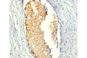 Formalin-fixed, paraffin-embedded human placenta stained with AMPD3 antibody (AMPD3/901)