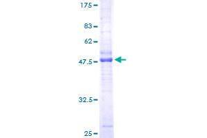 Image no. 1 for CKLF-Like MARVEL Transmembrane Domain Containing 3 (CMTM3) (AA 1-182) protein (GST tag) (ABIN1349789)