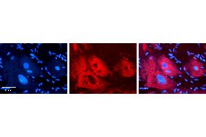 Rabbit Anti-EXT2 Antibody   Formalin Fixed Paraffin Embedded Tissue: Human heart Tissue Observed Staining: Cytoplasmic Primary Antibody Concentration: N/A Other Working Concentrations: 1:600 Secondary Antibody: Donkey anti-Rabbit-Cy3 Secondary Antibody Concentration: 1:200 Magnification: 20X Exposure Time: 0.