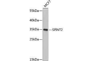 Western blot analysis of extracts of MCF-7 cells, using SPINT2 Antibody (ABIN6132838, ABIN6148361, ABIN6148362 and ABIN6222480) at 1:1000 dilution. (SPINT2 anticorps  (AA 28-197))