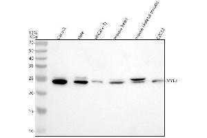 Western blot analysis of MYL3 using anti-MYL3 antibody (ABIN7602904).