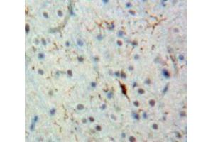 IHC-P analysis of Brain tissue, with DAB staining. (BCL9 anticorps  (AA 1118-1327))