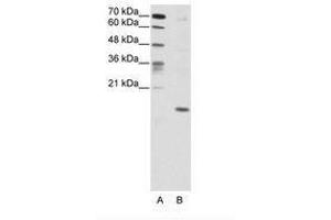 Image no. 1 for anti-Double Homeobox 5 (DUX5) (C-Term) antibody (ABIN203019) (DUX5 anticorps  (C-Term))