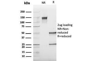 SDS-PAGE Analysis Purified Cathepsin K Mouse Monoclonal Antibody (CTSK/2793). (Cathepsin K anticorps  (AA 163-274))