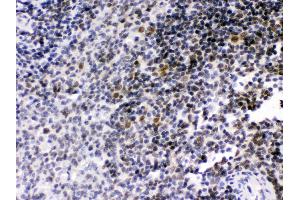Anti- RAG2 Picoband antibody, IHC(P) IHC(P): Rat Spleen Tissue (RAG2 anticorps  (C-Term))
