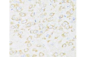 Immunohistochemistry of paraffin-embedded Mouse brain using DDX3Y Polyclonal Antibody at dilution of 1:100 (40x lens). (DDX3Y anticorps)