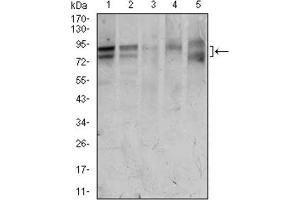 Western Blotting (WB) image for anti-Forkhead Box P1 (FOXP1) (AA 481-677) antibody (ABIN1845854)