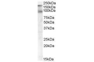 Image no. 2 for anti-CUB Domain Containing Protein 1 (CDCP1) (C-Term), (Isoform 1) antibody (ABIN374144) (CDCP1 anticorps  (C-Term, Isoform 1))