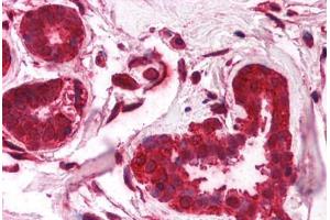 Human Breast (formalin-fixed, paraffin-embedded) stained with FOXO3 antibody ABIN214757 at 2.