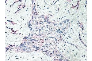 Immunohistochemistry (IHC) image for anti-Platelet Factor 4 (PF4) antibody (ABIN2476158)