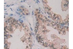 Detection of GR in Human Prostate Tissue using Polyclonal Antibody to Glutathione Reductase (GR)