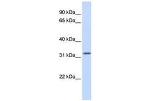 Image no. 1 for anti-Aprataxin (APTX) (AA 108-157) antibody (ABIN6742328) (Aprataxin anticorps  (AA 108-157))