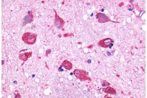Anti-GPR150 antibody  ABIN1048734 IHC staining of human brain, neurons and glia. (GPR150 anticorps  (N-Term))