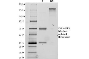 SDS-PAGE Analysis Purified Thyroglobulin Mouse Monoclonal Antibody (TGB24).