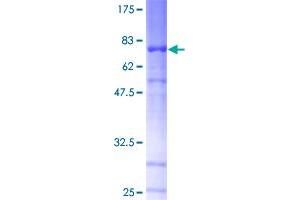 Netrin G1 (NTNG1) (AA 29-438) protein (GST tag)