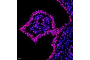 Immunofluorescence of paraffin embedded rat uterus using Skar (ABIN7074970) at dilution of 1:950 (400x lens) (p46 anticorps)