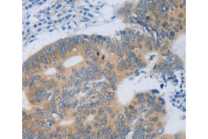 Immunohistochemistry (IHC) image for anti-Metallothionein 2A (MT2A) antibody (ABIN2421847) (MT2A anticorps)