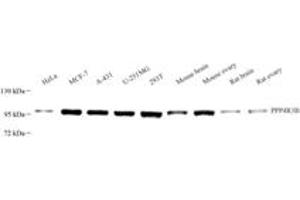 Western blot analysis of SMEK2 (ABIN7074520),at dilution of 1: 3000 (SMEK2 anticorps)