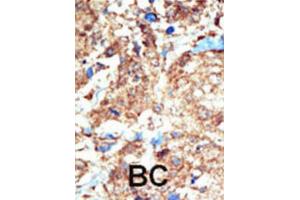 Immunohistochemistry (IHC) image for anti-EPH Receptor B1 (EPHB1) antibody (ABIN3003344) (EPH Receptor B1 anticorps)