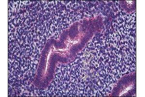Human Uterus, Endometrium: Formalin-Fixed, Paraffin-Embedded (FFPE) (IFITM1 anticorps)