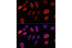 Immunofluorescence analysis of U-2 OS cells using SUN2 antibody (ABIN7270136) at dilution of 1:100. (SUN2 anticorps)