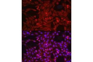 Immunofluorescence analysis of PC-12 cells using  Rabbit pAb (ABIN3015338, ABIN3015339, ABIN5663782 and ABIN6213995) at dilution of 1:50 (40x lens). (ADAM17 anticorps  (C-Term))