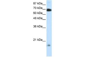 WB Suggested Anti-TRIM32 Antibody Titration: 0. (TRIM32 anticorps  (C-Term))