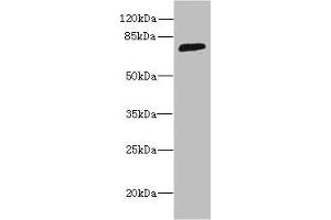 Western blot All lanes: SORBS3 antibody at 8 μg/mL + HepG2 whole cell lysate Secondary Goat polyclonal to rabbit IgG at 1/10000 dilution Predicted band size: 76, 37 kDa Observed band size: 76 kDa