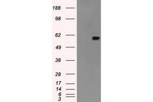 Image no. 3 for anti-Nuclear Receptor Binding Protein 1 (NRBP1) antibody (ABIN1499825)