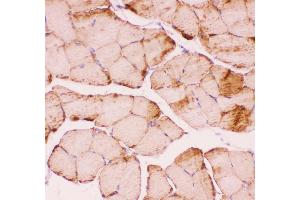 Anti-Desmin Picoband antibody,  IHC(P): Mouse Skeletal Muscle Tissue