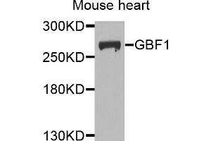 Western blot analysis of extracts of mouse heart, using GBF1 antibody.