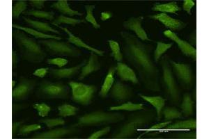 Immunofluorescence of purified MaxPab antibody to MALT1 on HeLa cell.