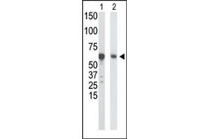 Western Blotting (WB) image for anti-Glucokinase (Hexokinase 4) (GCK) (N-Term) antibody (ABIN5552277) (GCK anticorps  (N-Term))