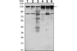 Western blot analysis using PTK7 mouse mAb against Hela (1), A431 (2), HCT116 (3), Caco2 (4), HepG2 (5) and MCF-7 (6) cell lysate. (PTK7 anticorps)