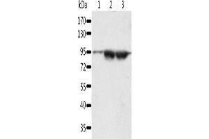 Gel: 10 % SDS-PAGE, Lysate: 60 μg, Lane 1-3: A549 cells, lncap cells, human seminoma tissue, Primary antibody: ABIN7192627(SPATA20 Antibody) at dilution 1/1000, Secondary antibody: Goat anti rabbit IgG at 1/8000 dilution, Exposure time: 5 minutes