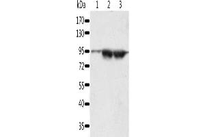Gel: 10 % SDS-PAGE, Lysate: 60 μg, Lane 1-3: A549 cells, lncap cells, human seminoma tissue, Primary antibody: ABIN7192627(SPATA20 Antibody) at dilution 1/1000, Secondary antibody: Goat anti rabbit IgG at 1/8000 dilution, Exposure time: 5 minutes (SPATA2 anticorps)